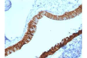 Formalin-fixed, paraffin-embedded human Ovary stained with Cytokeratin 3 Mouse Monoclonal Antibody (KRT3/2130). (Keratin 3 Antikörper)
