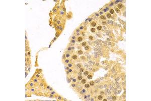 Immunohistochemistry (Paraffin-embedded Sections) (IHC (p)) image for anti-Replication Factor C (Activator 1) 4, 37kDa (RFC4) (AA 204-363) antibody (ABIN6146881)