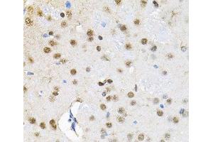 Immunohistochemistry of paraffin-embedded Rat brain using BAF60a Polyclonal Antibody at dilution of 1:100 (40x lens).