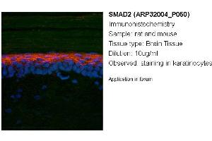 Image no. 2 for anti-SMAD, Mothers Against DPP Homolog 2 (SMAD2) (N-Term) antibody (ABIN2779412) (SMAD2 Antikörper  (N-Term))