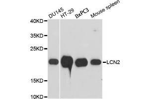 Western blot analysis of extracts of various cell lines, using LCN2 antibody (ABIN1873521) at 1:3000 dilution. (Lipocalin 2 Antikörper)
