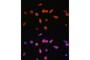 Immunofluorescence analysis of L929 cells using R Rabbit pAb (ABIN7269800) at dilution of 1:100. (RAB20 Antikörper  (AA 80-190))