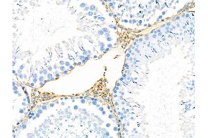 ABIN6259135 and ABIN6275366 at 1/100 staining Rat testis tissue by IHC-P. (nectin-3 Antikörper  (Internal Region))