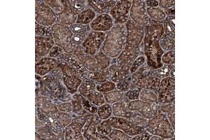 Immunohistochemical staining of human kidney with TRIM7 polyclonal antibody  shows strong cytoplasmic positivity in tubular cells at 1:200-1:500 dilution. (TRIM7 Antikörper)