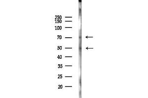 Western blot analysis of lysates from MCF7 cells(heat-shock,45 min treatment), using Phospho-Tau (Ser262)[Ser579] Antibody at 1/1000 dilution.