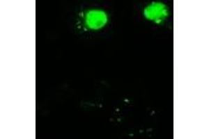 Anti-AKT3 mouse monoclonal antibody (ABIN2452528) immunofluorescent staining of COS7 cells transiently transfected by pCMV6-ENTRY AKT3 (RC221051).