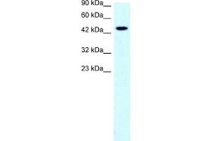 WB Suggested Anti-SLC17A2 Antibody Titration:  0. (SLC17A2 Antikörper  (Middle Region))