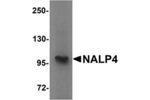 Western blot analysis of NALP4 in K562 cell lysate with NALP4 antibody at 1 μg/ml. (NLRP4 Antikörper  (Center))