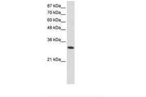 Image no. 1 for anti-AIMP1 / EMAP II (AA 31-80) antibody (ABIN6736246) (AIMP1 / EMAP II (AA 31-80) Antikörper)