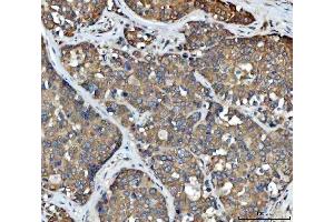 IHC analysis of FADS1 using anti-FADS1 antibody (ABIN7599175). (FADS1 Antikörper  (AA 1-257))