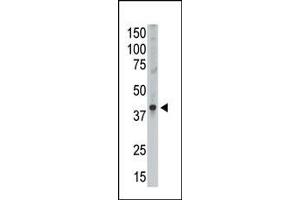 The anti-GEA9 Ctr Antibody (ABIN390111 and ABIN2840622) is used in Western blot to detect GEA9 in Placenta lysate. (MAGEA9 Antikörper  (AA 171-198))