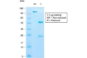 SDS-PAGE Analysis of Purified Cytokeratin 10 Rabbit Recombinant Monoclonal Antibody (KRT10/1990R). (Rekombinanter Keratin 10 Antikörper)