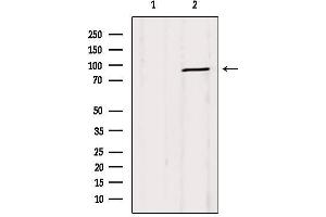 Western blot analysis of extracts from Mouse lung, using DRP1  Antibody. (Dynamin 1-Like Antikörper  (C-Term))