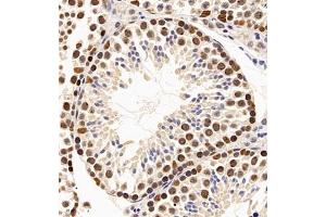 Immunohistochemistry (Paraffin-embedded Sections) (IHC (p)) image for anti-Protein Phosphatase 4, Regulatory Subunit 2 (PPP4R2) antibody (ABIN7075284)
