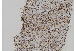 ABIN6264680 and ABIN6272412 at 1/100 staining Human spleen tissue by IHC-P. (RCC2 Antikörper  (C-Term))