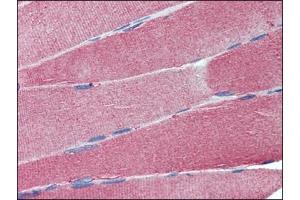 Immunohistochemistry: Human Skeletal Muscle: Formalin-Fixed, Paraffin-Embedded (FFPE). (Cell Adhesion Molecule 4 Antikörper  (Internal Region))