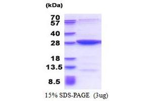SDS-PAGE (SDS) image for MOB Kinase Activator 3B (MOB3B) (AA 1-216) protein (His tag) (ABIN5853502) (MOBKL2B Protein (AA 1-216) (His tag))