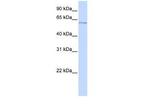WB Suggested Anti-ME2 Antibody Titration:  0. (NAD-ME Antikörper  (N-Term))