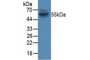 Detection of CCNB in Human Jurkat Cells using Polyclonal Antibody to Cyclin B (CCNB) (Cyclin B1 Antikörper  (AA 239-433))