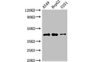 Western Blot Positive WB detected in: A549 whole cell lysate, HepG2 whole cell lysate, U251 whole cell lysate All lanes: B4GALT2 antibody at 3. (B4GALT2 Antikörper  (AA 271-372))