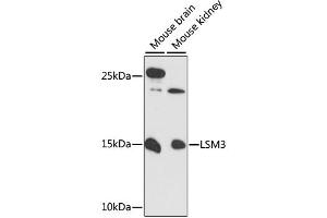 Western blot analysis of extracts of various cell lines, using LSM3 antibody (ABIN6292511) at 1:3000 dilution. (LSM3 Antikörper)