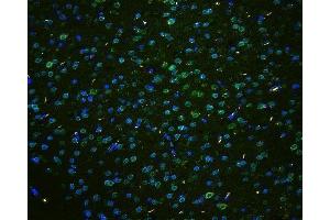 IF analysis of TPR using anti-TPR antibody (ABIN5693275) TPR was detected in paraffin-embedded section of mouse brain tissues. (TPR Antikörper)