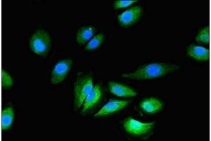 Immunofluorescent analysis of A549 cells using ABIN7153992 at dilution of 1:100 and Alexa Fluor 488-congugated AffiniPure Goat Anti-Rabbit IgG(H+L) (GRIN2C Antikörper  (AA 908-1007))