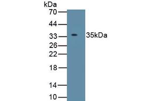 Western Blotting (WB) image for anti-Insulin-Like Growth Factor Binding Protein 2, 36kDa (IGFBP2) (AA 34-317) antibody (ABIN7430591)