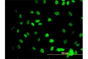 Immunofluorescence of monoclonal antibody to GATA2 on HeLa cell. (GATA2 Antikörper  (AA 1-102))