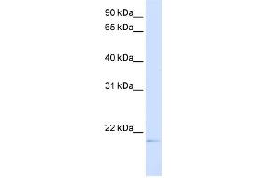 WB Suggested Anti-C14orf180 Antibody Titration:  0. (C14orf180 Antikörper  (Middle Region))