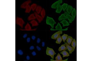 ABIN6266215 and ABIN6277373 staining Hela cells(30 min of UV treatment) by IF/ICC. (Connexin 31 Antikörper  (C-Term))