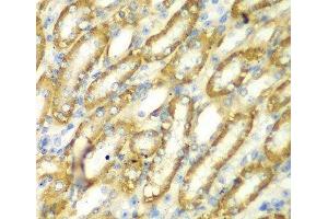 Immunohistochemistry of paraffin-embedded Mouse kidney using TM9SF1 Polyclonal Antibody at dilution of 1:100 (40x lens). (TM9SF1 Antikörper)