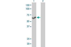 Western Blotting (WB) image for anti-Protein Phosphatase 3, Catalytic Subunit, beta Isozyme (PPP3CB) (AA 435-524) antibody (ABIN562356)