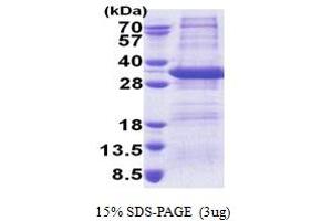SDS-PAGE (SDS) image for Syntaxin 17 (STX17) (AA 1-229) protein (His tag) (ABIN5853261)