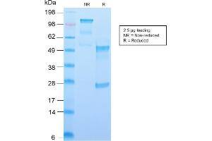 SDS-PAGE Analysis Purified CD34 Recombinant Rabbit Monoclonal Antibody (HPCA1/2598R). (Rekombinanter CD34 Antikörper)