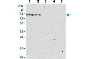 Western blot analysis of Lane 1: RT-4, Lane 2: U-251 MG, Lane 3: Human Plasma, Lane 4: Liver, Lane 5: Tonsil with DDX51 polyclonal antibody  at 1:250-1:500 dilution. (DDX51 Antikörper)