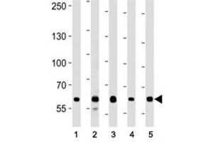 Western Blotting (WB) image for anti-Forkhead Box P1 (FOXP1) (AA 650-677) antibody (ABIN3030993)