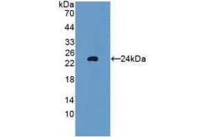 Western blot analysis of recombinant Rat GPX5. (GPX5 Antikörper  (AA 22-221))