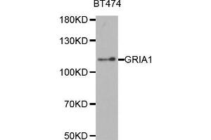 Glutamate Receptor 1 Antikörper  (AA 19-300)