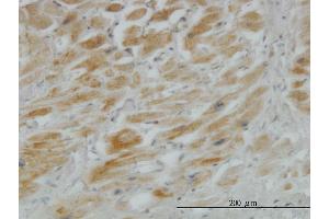 Immunoperoxidase of monoclonal antibody to HHIP on formalin-fixed paraffin-embedded human heart. (HHIP Antikörper  (AA 21-120))