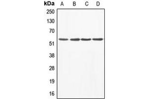 Western blot analysis of ABI1 expression in A549 (A), MCF7 (B), mouse liver (C), rat heart (D) whole cell lysates. (ABI1 Antikörper  (Center))