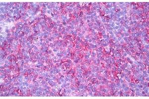 Anti-HLA-DR antibody IHC staining of human thymus, medulla. (HLA-DR Antikörper)