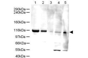 Image no. 1 for anti-ATPase Family, AAA Domain Containing 5 (ATAD5) (AA 63-76) antibody (ABIN401276) (ATAD5 Antikörper  (AA 63-76))