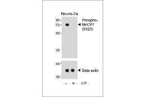 Western blot analysis of lysates from Neuro-2a cell line, untreated or treated with calf intestinal alkaline phosphatase(CIP), using Phospho-MeCP2 Antibody (upper) or Beta-actin (lower). (MECP2 Antikörper  (pSer423))