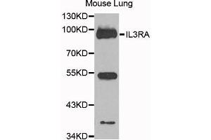 Western blot analysis of extracts of mouse lung cells, using IL3RA antibody. (IL3RA Antikörper)