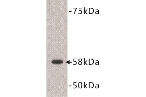 Western Blotting (WB) image for anti-Deoxynucleotidyltransferase, terminal (DNTT) (C-Term) antibody (ABIN1854983) (TdT Antikörper  (C-Term))