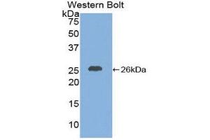 Western Blotting (WB) image for anti-Chemokine (C-X-C Motif) Ligand 16 (CXCL16) (AA 46-242) antibody (ABIN1858582)