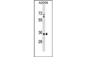 Western blot analysis of SPEM1 Antibody (Center) in A2058 cell line lysates (35ug/lane). (SPEM1 Antikörper  (Middle Region))