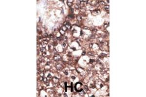 Immunohistochemistry (Paraffin-embedded Sections) (IHC (p)) image for anti-Low Density Lipoprotein Receptor-Related Protein 8, Apolipoprotein E Receptor (LRP8) (AA 934-963), (C-Term) antibody (ABIN390101)