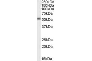 Western Blotting (WB) image for anti-STEAP Family Member 4 (STEAP4) (AA 441-456) antibody (ABIN297718)